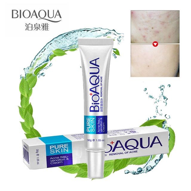 Bioaqua Acne Cream Scars Removal Face Cream onide.lk