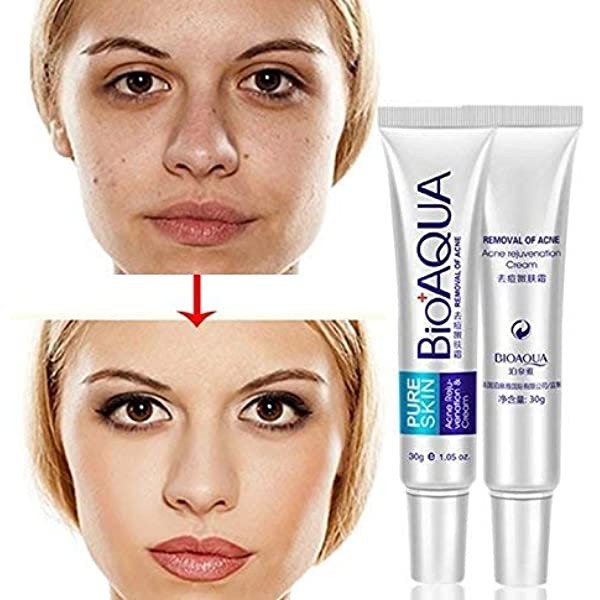 Bioaqua Acne Cream Scars Removal Face Cream onide.lk
